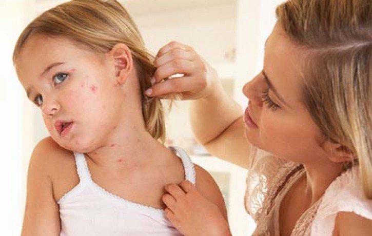 Кір – небезпечна хвороба